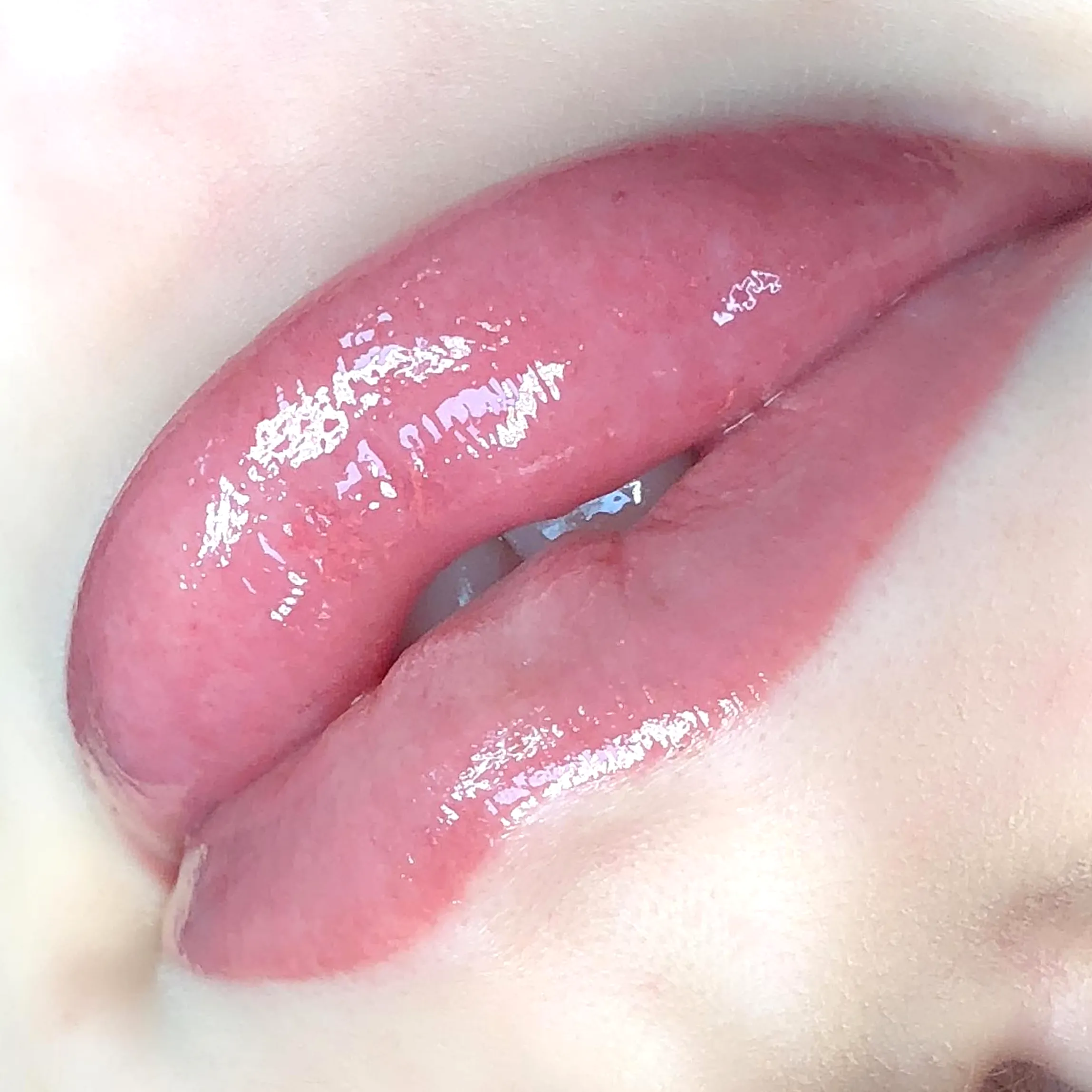 Can Lip Blush Correct Asymmetry or Camouflage Scars?
